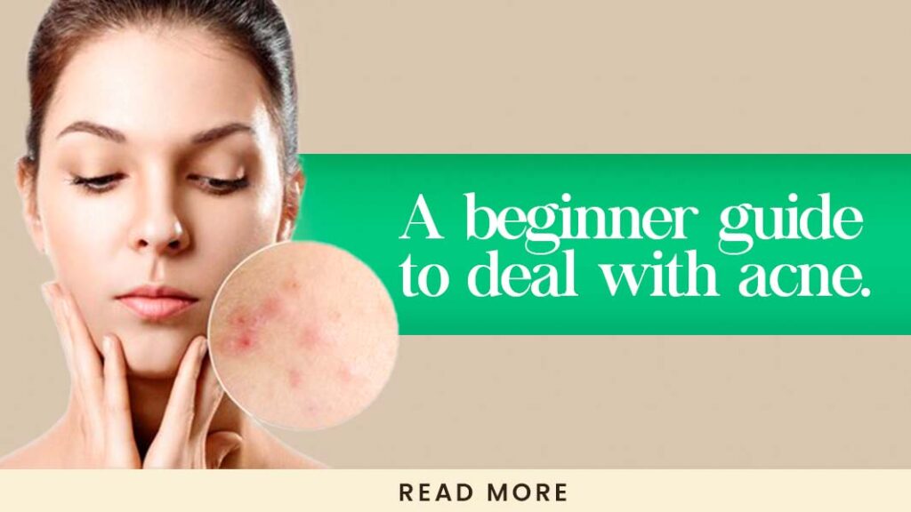 A Beginner's Guide to Dealing with Acne